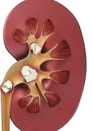 Bài giảng suy thận cấp